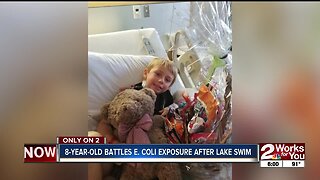 8-year-old battles E. coli exposure after lake swim