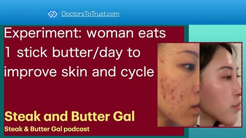 STEAK & BUTTER GAL | Experiment: woman eats1 stick butter/day to improve skin and cycle