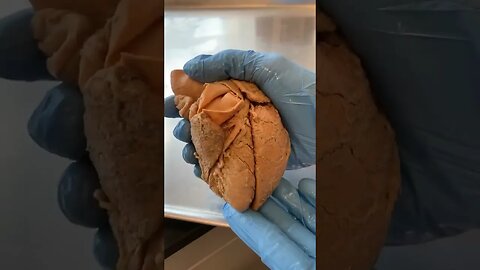 Can the Heart Survive Outside the Body?