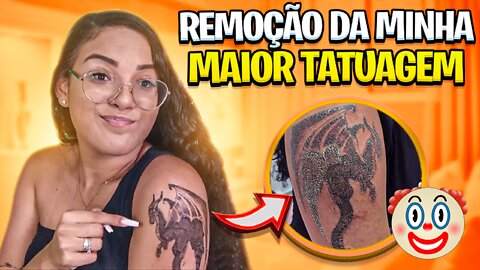 REMOÇÃO DA MINHA MAIOR TATUAGEM - tirando algumas dúvidas