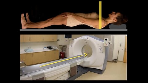 Anatomy of CT scans: Introduction