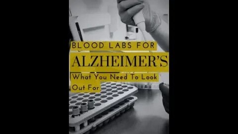 Blood Tests For Alzheimers