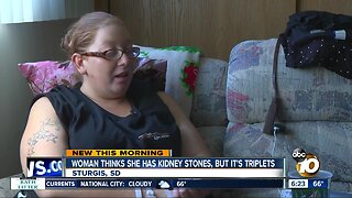 Woman thought she had kidney stones, but it was triplets!