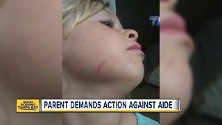 Teacher's aide accused of injuring child's mouth