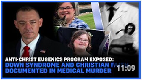 Eugenics Program Exposed: Down Syndrome And Christian Faith Documented In Medical Murder