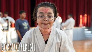 The 'Karate' Teen With Butterfly Skin | BORN DIFFERENT