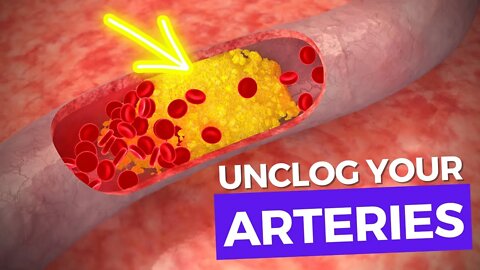 How to Unclog Arteries and Reduce Cholesterol Naturally