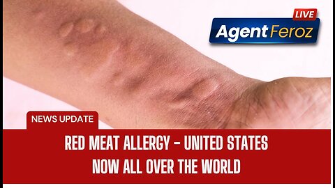 Red Meat Allergy - United States - Now all over the world #allergy #unitedstates