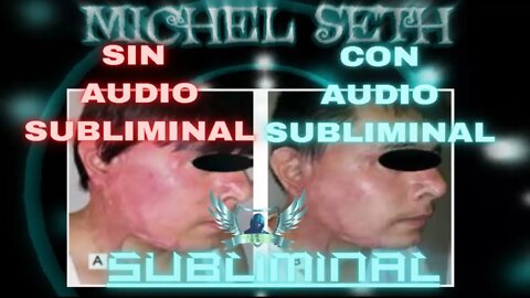 Sanar Quemaduras - Audio Subliminal 2021