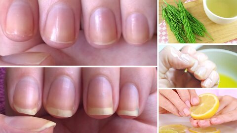 How to Grow Nails Faster & Stronger: 7 Best Home Remedies