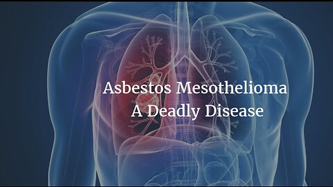 Remodeling and breaking building materials? Be aware of asbestos which might cause Mesothelioma