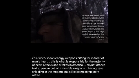 TSVN370 8.2033 Video Showing Energy Weapons Hitting Foil In Front Of A Man’s Heart