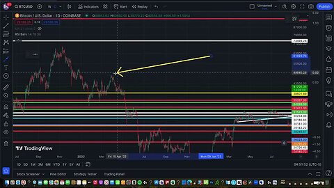 XRP Market Volatility!