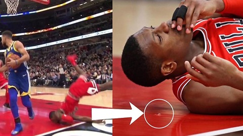 Kris Dunn Lands FACE FIRST After Dunk, Leaves His TEETH on the Court!!