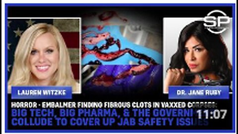 HORROR: Embalmer Finding Fibrous Clots In Vaxxed Corpses;