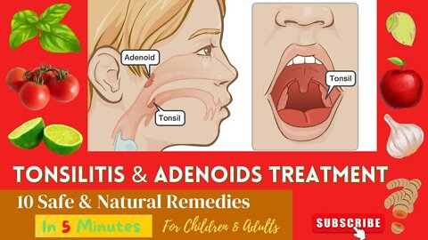 10 Best Effective Proven Home Remedies For Enlarge | Swelling ADENOIDS and TONSILS In Children