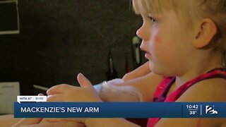 2-y.o soon to have new arm after lawn mower accident
