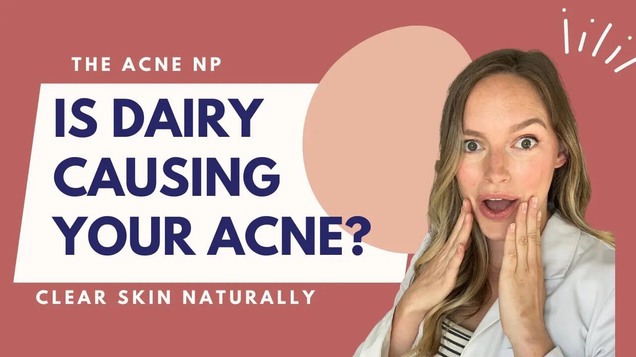 Is Dairy Causing Your Acne?