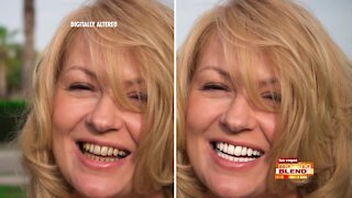 The Easy Way to a Whiter Smile