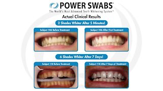 Give your smile a boost with Power Swabs
