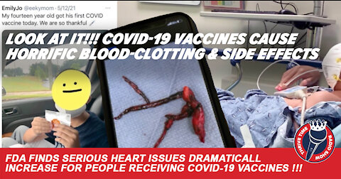 LOOK AT IT!!! COVID-19 Vaccines Cause Horrific Blood-Clotting & Side-Effects