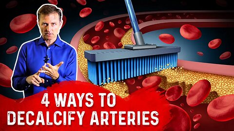 4 Ways To Decalcify Your Arteries – Dr. Berg