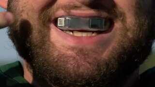 Mouth guard technology detects head impacts, concussions
