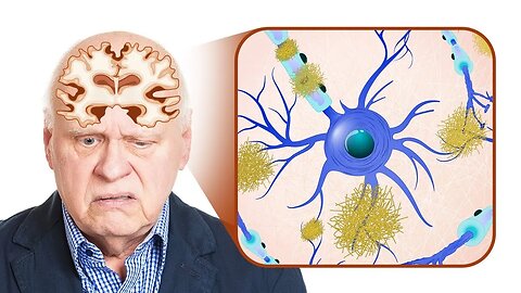 Genetically at Risk for Alzheimer's Disease? DO THIS...