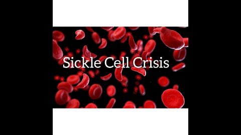 Sickle Cell Anemia/ Disease Sickle Cell Crisis