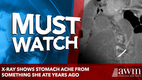 X-Ray Shows stomach ache From Something She Ate Years Ago