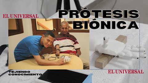 Las prótesis biónicas transforman vidas en Mompox