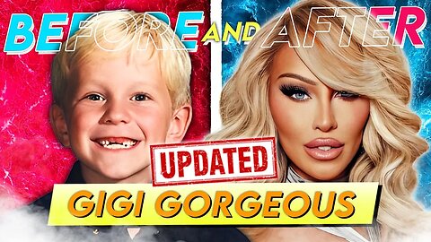 Gigi Gorgeous | Before & After | Her Full Transformation | UPDATE