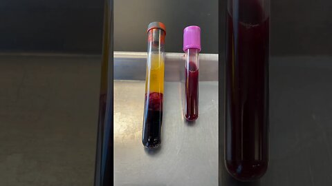 What Your Blood is Made Of!