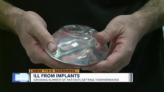 Ill from implants: growing number of patients getting them removed
