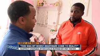 'This is my worst nightmare come true:' Father reacts to 1-year-old child left in scalding hot water