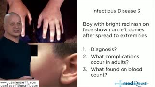 Infectious Disease - Section 1 - MedQuest