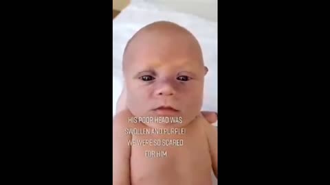 bebés transhumanos tras vacuna covid / transhuman baby