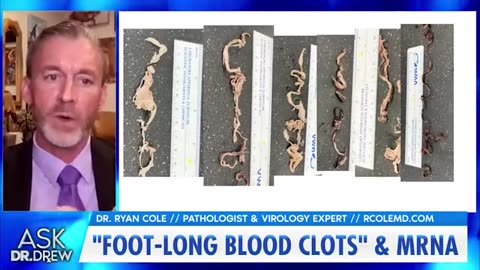 Pathologist, Dr. Ryan Cole, tells Dr. Drew about the strange, foot-long clots