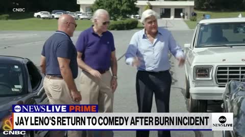 JAY LENO'S RETURN TO COMEDY AFTER BURN INCIDENT