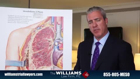 Mesothelioma Lawyer | Outlining The Process of Malignant Mesothelioma Diagnosis