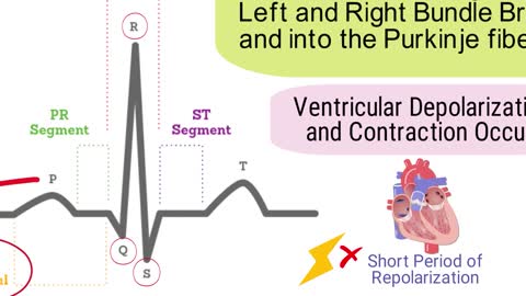 What is an Electrocardiogram? (EKG/ECG) *SIMPLE Explanation*