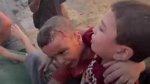 Palestinian brothers from Gaza thank paramedics for their rescue Very Sad