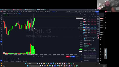 Candlesticks "the most important basic fundamental in trading"