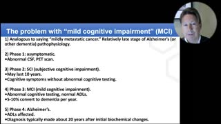 The 4 Phases Of Alzheimer's Disease