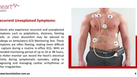 When Do Doctors Suggest An Ambulatory ECG Monitoring Test