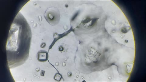 Lidocain, Novolin Human Insuline Crystals, Budocain Forte and Mepivacainum Injections