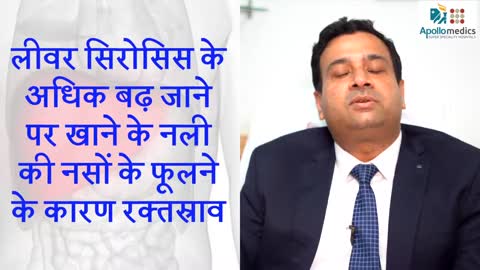 Best Liver Surgeon in Gorakhpur