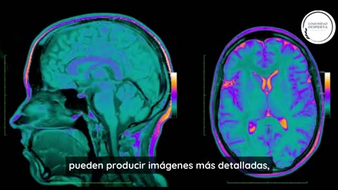 Meta IA usando ondas cerebrales