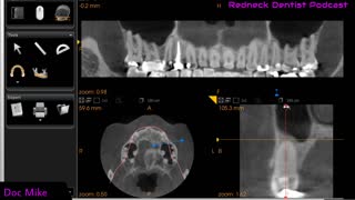 cbct 1