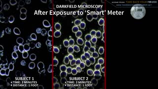 Smart Meter Effects On Blood